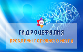 Причины и особенности гидроцефалии