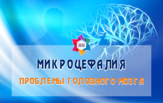 Причины и особенности микроцефалии